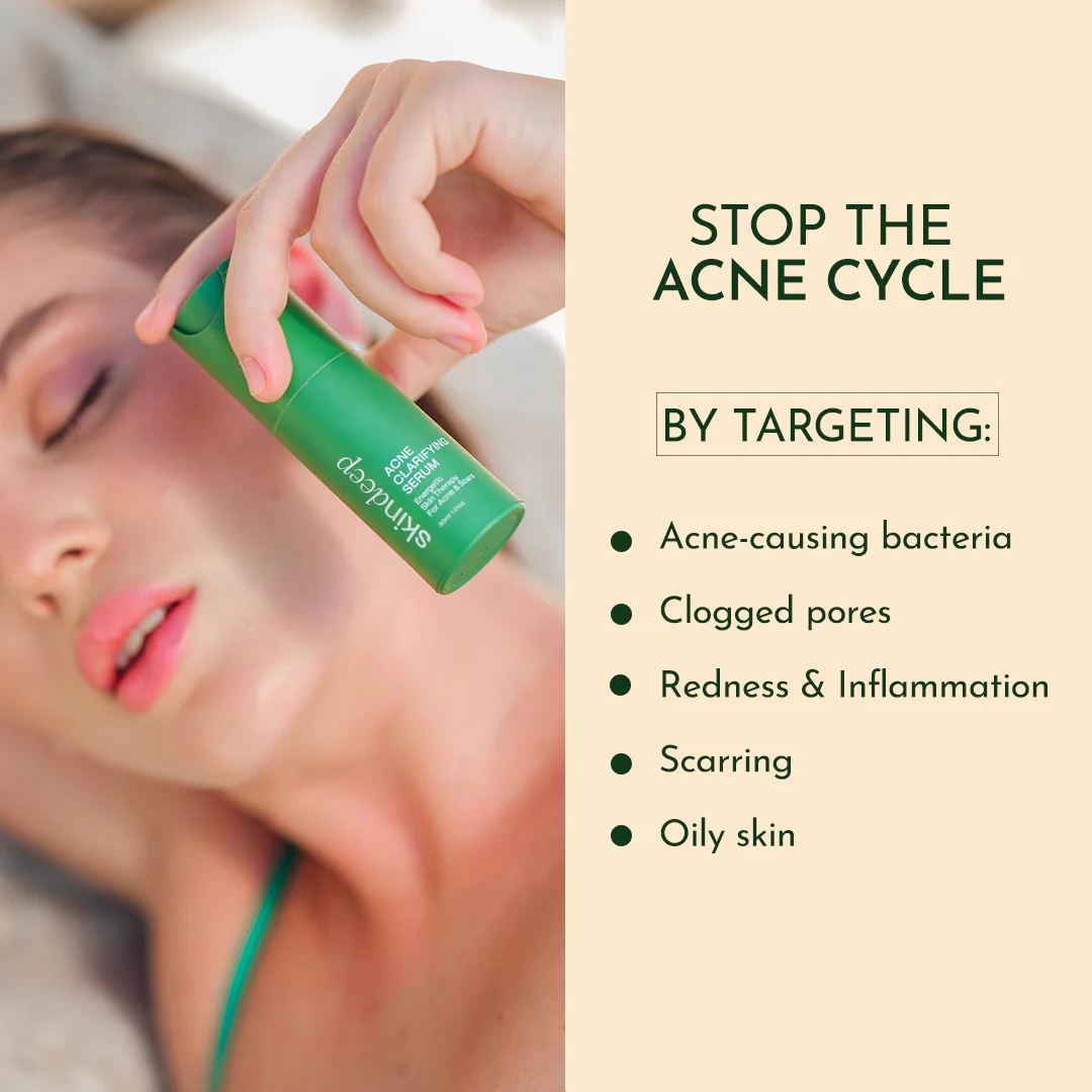 ACNE CLARIFYING SERUM - Energetic Skin Therapy for Acne & Scars - Image 3