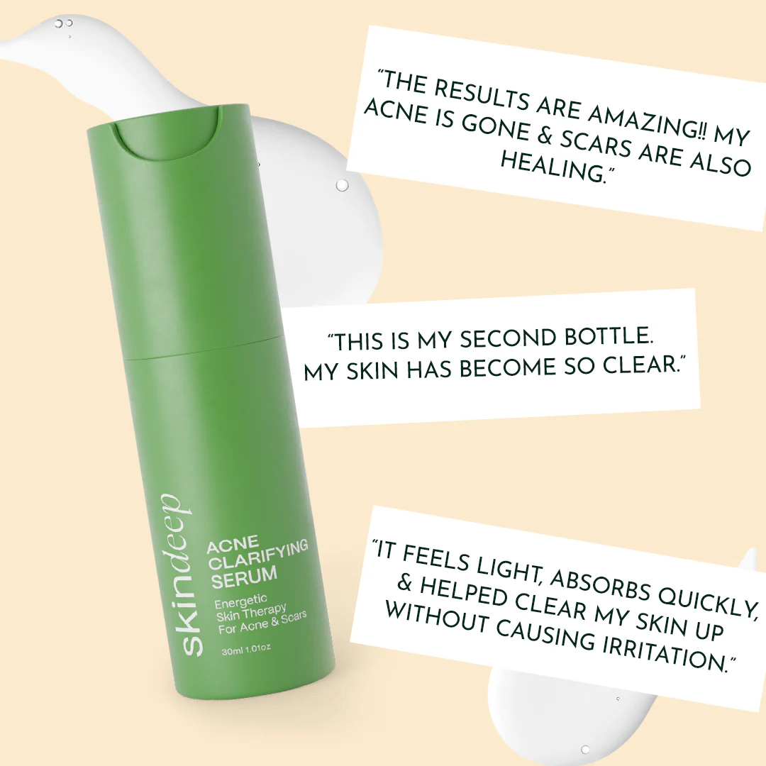 ACNE CLARIFYING SERUM - Energetic Skin Therapy for Acne & Scars - Image 5