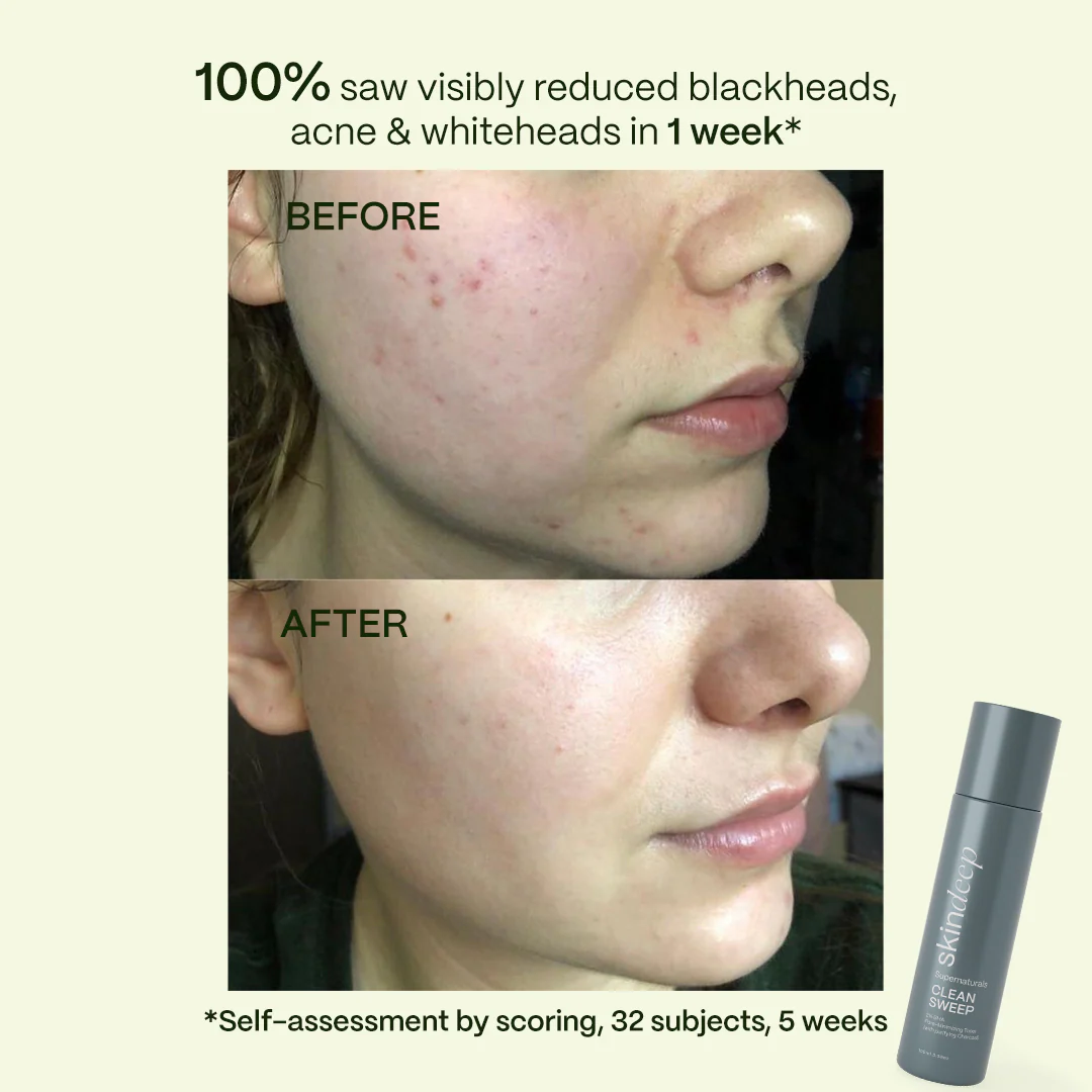 CLEAN SWEEP - 2% BHA Pore-Minimizing Toner (w/ purifying Charcoal) - Image 3