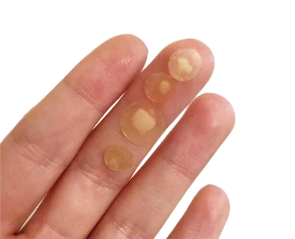 MIRACLE PATCH - Acne Healing & Blemish Spot Treatment - Image 3