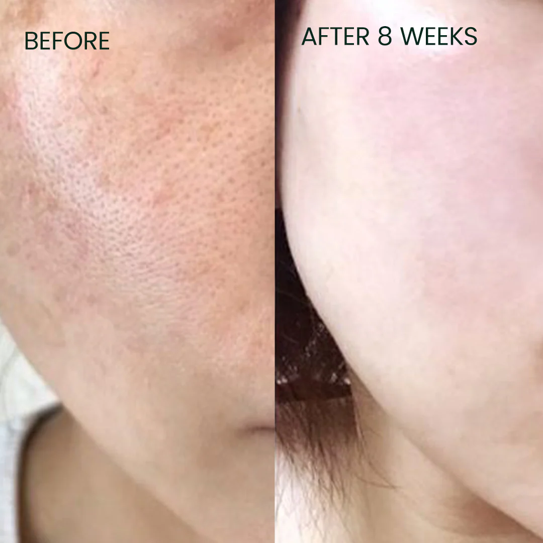 Vit C BURST - Antioxidant Face Serum - Image 4